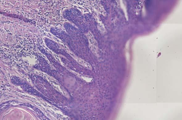 M. Robenek et al.
