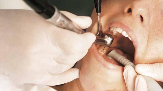 W latach 60-tych była to jednak rewolucja, którą umożliwiło wporawadzenie przez firmę Dürr Dental innowacji w postaci