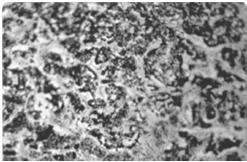 przysadki można identyfikować immunohistochemicznie Typ komórki Wielkość ziarn Produkowane hormony Kwasochłonne Somatotropy 300-400 nm GH (STH)