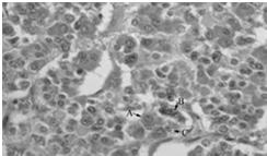 somatotropy kortykotropy gonadotropy mammotropy Tyreotropy 120-200 nm TSH.