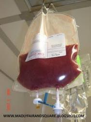 Etapy transplantacji komórek krwiotwórczych Przeszczepienie Terapia (np.