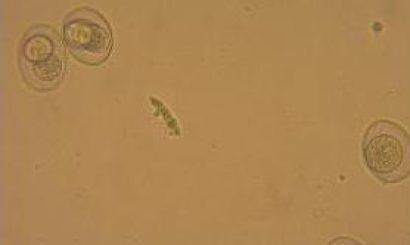 metodami flotacji i sedymentacji u psów i kotów 7 Fot. 9.2. Cystoisospora sp. Drugą co do wielkości grupą nicieni jelitowych, których jaja wykrywane są metodami flotacji i sedymentacji, są tęgoryjce.