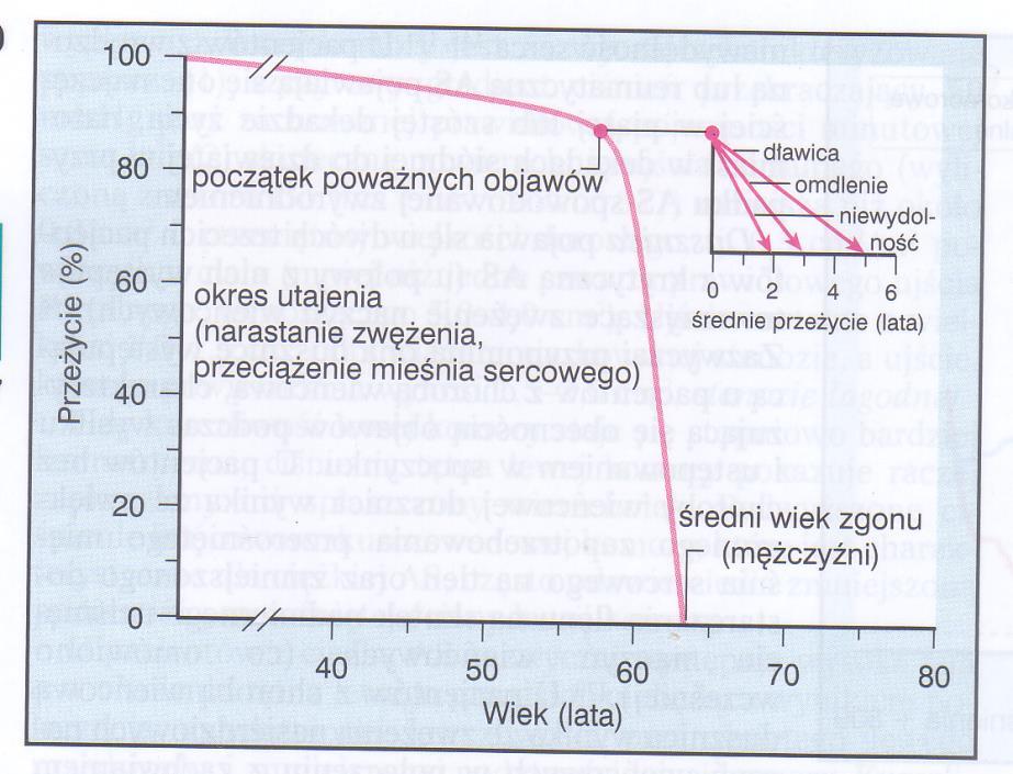 POWIKŁANIA zatory obwodowe infekcyjne zapalenie wsierdzia nabyta choroba