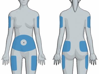 Zasady zmiany miejsc podawania insuliny: odstęp pomiędzy wkłuciami ok 1 cm, w ten sam obszar ciała insulinę należy podawać przez około 2 tygodnie, a następnie zmienić obszar np. z prawego uda na lewe.