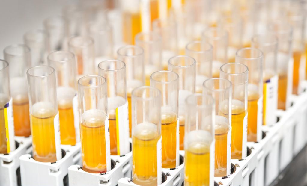 Komisja Europejska Zestawienie informacji dla producentów wyrobów medycznych do diagnostyki in vitro Niniejsza nota informacyjna kierowana jest do producentów wyrobów medycznych do diagnostyki in
