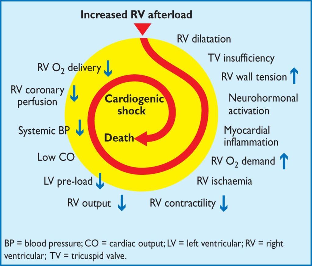 Key factors contributing to haemodynamic collapse in acute pulmonary embolism. Authors/Task Force Members et al.