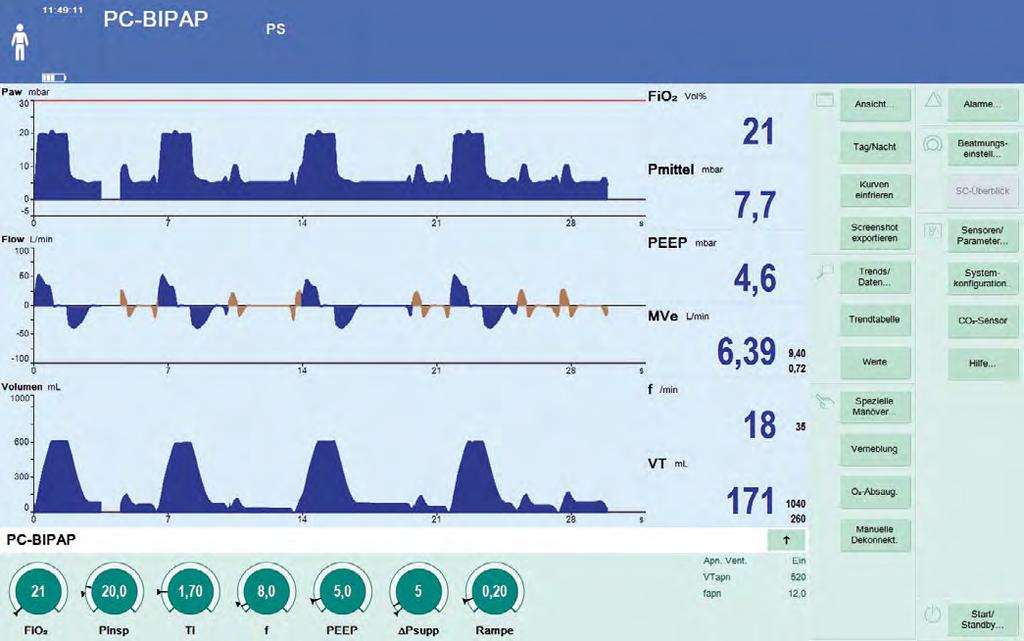PC-BIPAP VS.