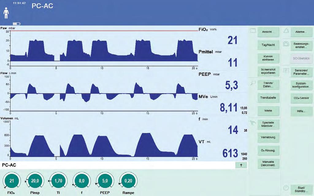 6 PC-BIPAP VS. PC-AC Zastosowanie PC-AC powoduje, że każda rozpoznana przez respirator próba oddechu na poziomie ustalonego PEEP wywołuje oddech obowiązkowy.