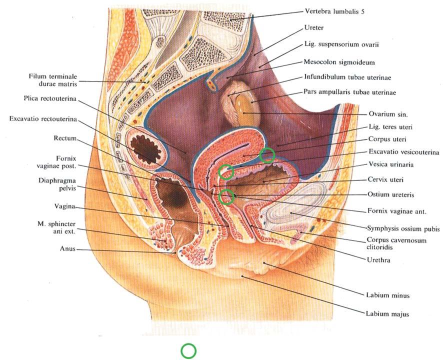 42 R. PORĘBA, J. POZOWSKI możliwa lokalizacja uszkodzeń pęcherza moczowego possible localization of the urinary bladder lesions Ryc. 4.