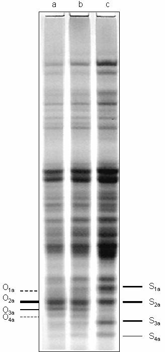 Rys. 3. Wzorce białek gliadynowych obserwowane u mieszańców pokolenia F 2 kombinacji kbh-sp 1 STH 9055: a. typ kbh-sp 1, b. heterozygota pod względem locus Gli A2, c. typ STH 9055.