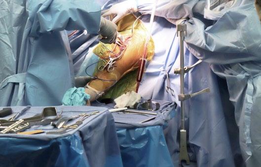 University. He completed his general surgical training at Georgetown University Medical Center and his orthopaedic surgical training at Brown University, Rhode Island Hospital. Dr.