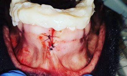 Stomatologia zwierząt to moja pasja 10 Stabilizacja separacji szwu siekaczowego. Jak Pani widzi przyszłość stomatologii weterynaryjnej, w jakim kierunku będzie się ona rozwijać?