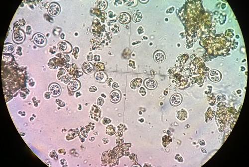 Toksoplazmoza prawda i mity, czyli odczarowujemy kota 4 Fot. 1. Oocysty Toxoplasma gondii znalezione w kale 3-letniego kota. Preparat mikroskopowy wykonany metodą rozmazu bezpośredniego, pow. 1000x.