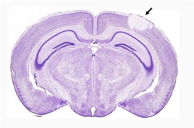 Neurobiologia (dr Jan Jabłonka) Wpływ zmiany ekspresji wybranych białek na plastyczność mózgu po udarze różnice