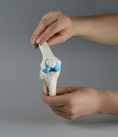 Model implantu stawu kolanowego Nr ref: MA01199