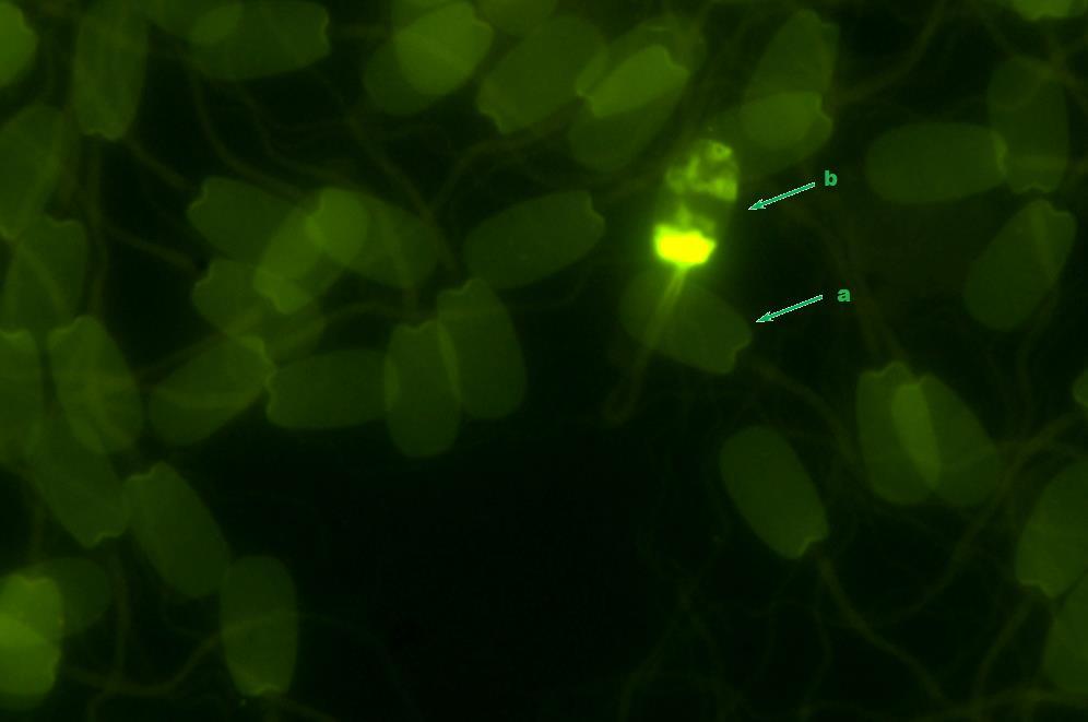 Fotografia 6. Plemniki knura barwione chromomycyną A3 - wysoka koncentracja plemników w preparacie; a - plemnik prawidłowy, b - plemnik o zaburzonej protaminacji; barwienie fluorescencyjne. 4.1.3. Barwienie oranżem akrydyny Oranż akrydyny selektywnie wybarwia plemniki z prawidłową, natywną strukturą DNA i z uszkodzonym, jednoniciowym DNA.