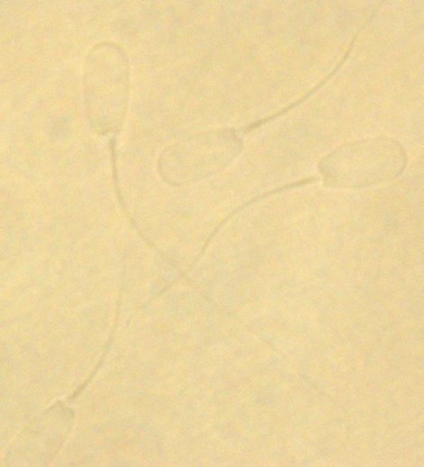 Fotografia 8. Plemniki knura niebarwione, kontrast fazowy. 4.2.1. Barwienie Papanicolaou W przypadku barwienia Papanicolau, główki plemników knurów wybarwiały się na jasnofioletowy kolor.
