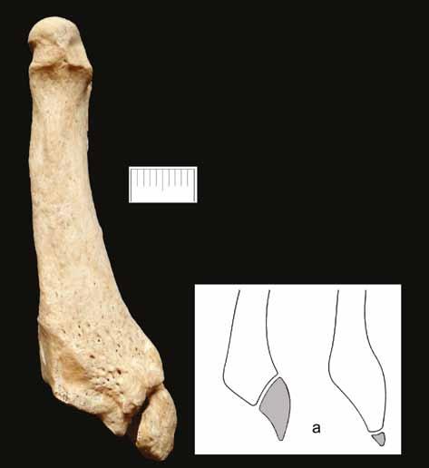 Obecne są także kości stopy prawej: piętowa, skokowa, łódkowata, sześcienna, kości klinowate, 5 kości śródstopia paliczek dalszy palucha, 2 trzeszczki, 3 paliczki oraz częściowo zniszczone kości