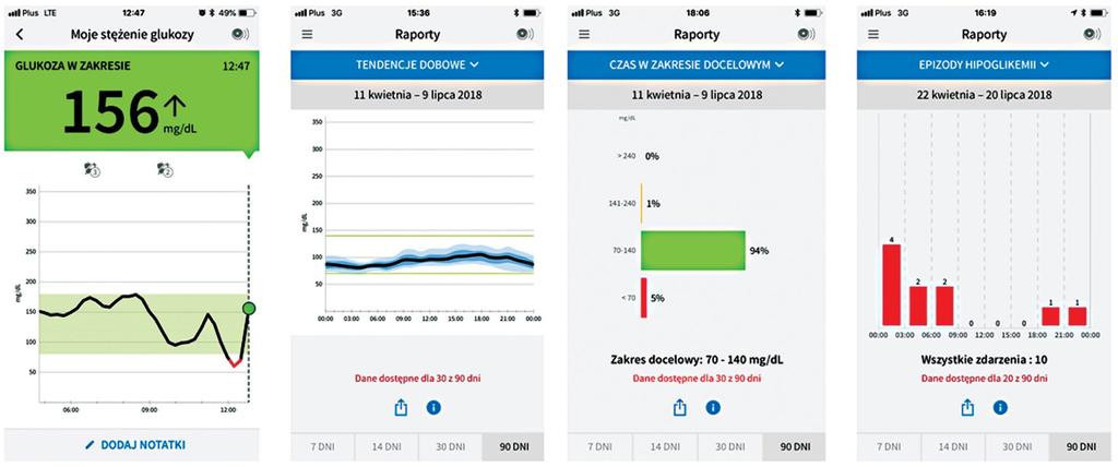 Diabetologia Praktyczna 2019, tom 5, nr 2 Bieżący odczyt glikemii Analiza AGP Czas w określonych zakresach Zdarzenia hipoglikemii Rycina 1.