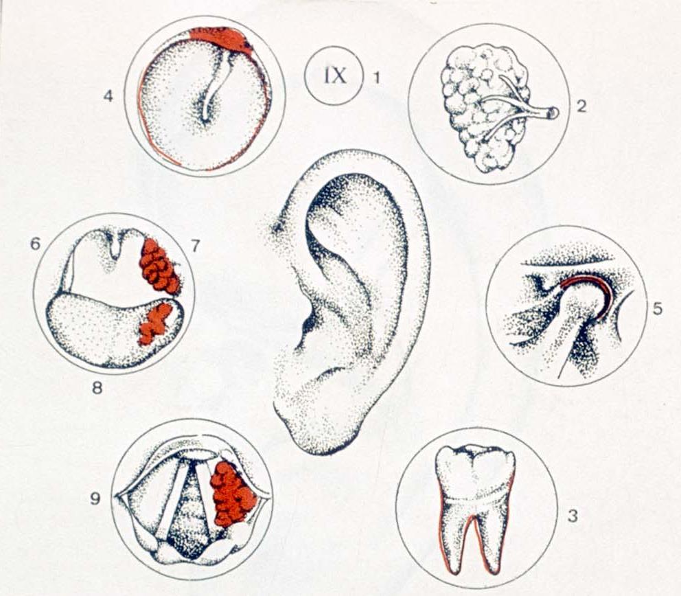 1. Nerw językowo-gardłowy, 2. Ślinianka przyuszna, 3. Zęby, 4.