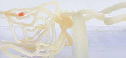Dlaczego medycyna potrzebuje druku 3D? RAPORTY MrR Technologia przyrostowa znana jest od ponad 30 lat. Drukarki 3D początkowo spełniały rolę urządzeń do prototypowania.