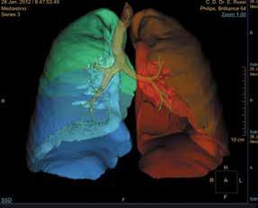 Przygotowanie modelu anatomicznego Przygotowanie spersonalizowanego modelu anatomicznego, musi uwzględniać specyficzny charakter danych będących źródłem informacji dla dalszych etapów produkcji.