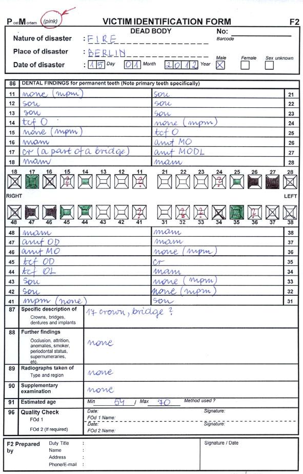 Zadania lekarza dentysty w identyfikacji ofiar katastrof wytyczne i formularze Interpolu Rycina 2.
