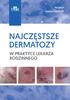 NAJCZĘSTSZE DERMATOZY