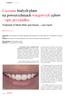 Leczenie białych plam na powierzchniach wargowych zębów opis przypadku