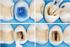 Systematyczna adhezyjna odbudowa zrębu zęba