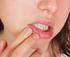 Dolegliwości w jamie ustnej zgłaszane przez dzieci z astmą