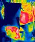 TERMOWIZYJNA OCENA ZMIAN TEMPERATURY W TKANCE PODCZAS TERMOTERAPII LASEROWEJ IN VITRO