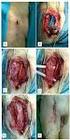 Prosthetic graft infection treated by local surgery comparative analysis of 64 consecutive cases