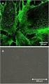 SDF-1α/CXCL12 and dendritic cells in ovarian cancer microenvironment