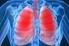 Leczenie drugiej linii w niedrobnokomórkowym raku płuca