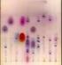 Ryc. 1 przykład chromatogramu w analizie mikotoksyn w technice HPLC. Interpretacja wyników badań pod kątem mikotoksykologicznym