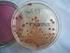 X. Diagnostyka mikrobiologiczna bakterii chorobotwórczych z rodzaju: Corynebacterium, Mycobacterium, Borrelia, Treponema, Neisseria