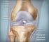 Posterior cruciate ligament injuries and its treatment