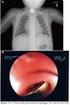 Progress in gastrointestinal endoscopy 2006 upper gastrointestinal tract
