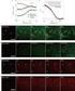 In situ spectroscopic analysis of lipids and other biochemical changes in the selected models of liver injury