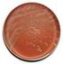 BD Chocolate Agar (GC II Agar with IsoVitaleX ) BD Chocolate Agar (Blood Agar No. 2 Base)