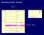 High pressure low flow - obstructed BOO. Qmax Pdet. Compliance 1. Uro - Voiding Cystometry#2. Vinfus 200 ml. 200 Pdet cmh2o 100. Pves. cmh2o.